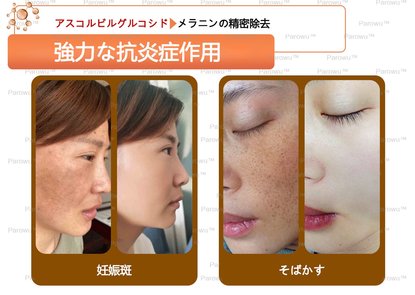 Parowu™シミ・色素沈着除去&美白マスク(✨天然成分でシミ、色素沈着、日焼けによるシミを長期的にケア)