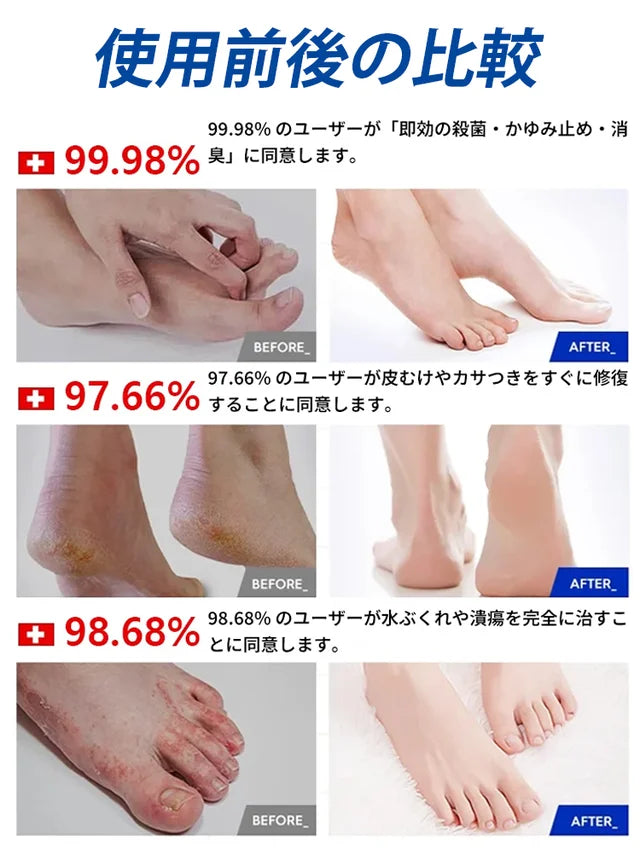 【14日間で爪水虫を根治】爪白癬対策の殺菌消毒水虫薬