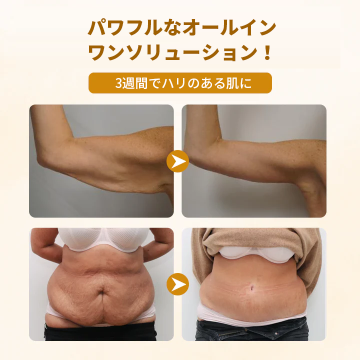 Timilk® ビーヴェノム コンプレックス リペアクリーム