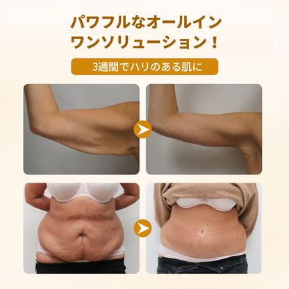 Timilk® ビーヴェノム コンプレックス リペアクリーム