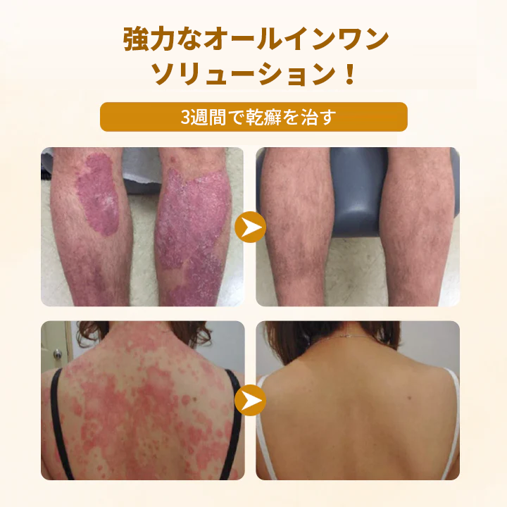 Timilk® ビーヴェノム コンプレックス リペアクリーム