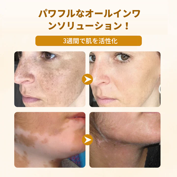 Timilk® ビーヴェノム コンプレックス リペアクリーム