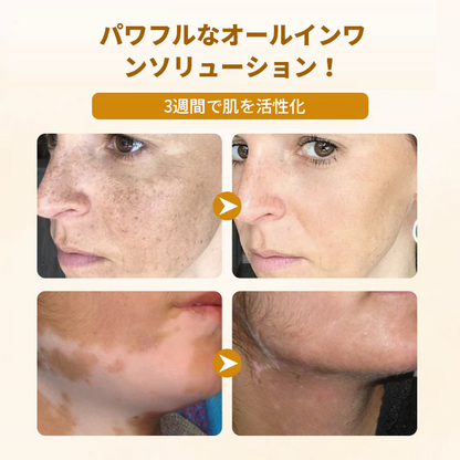 Timilk® ビーヴェノム コンプレックス リペアクリーム