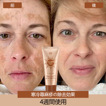 Parowu™シミ・色素沈着除去＆美白マスク(✨天然成分でシミ、色素沈着、日焼けによるシミを長期的にケア)