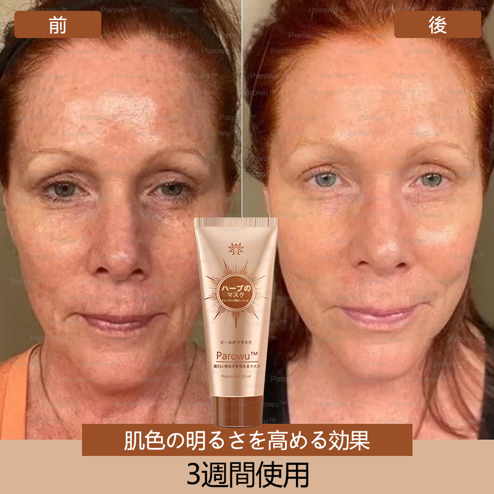 Parowu™シミ・色素沈着除去＆美白マスク(✨天然成分でシミ、色素沈着、日焼けによるシミを長期的にケア)