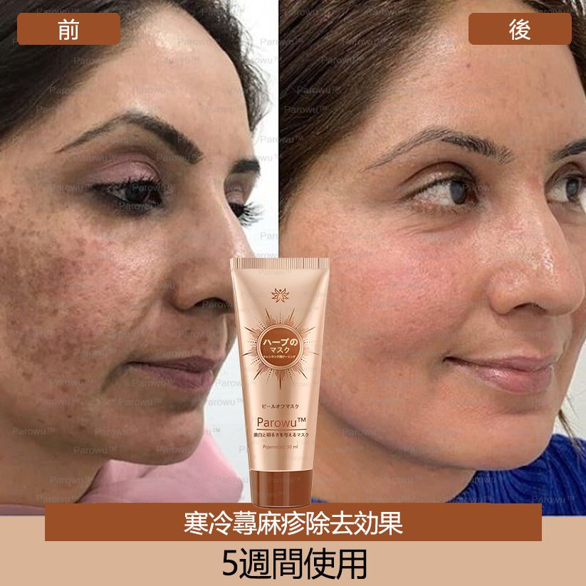 Parowu™シミ・色素沈着除去＆美白マスク(✨天然成分でシミ、色素沈着、日焼けによるシミを長期的にケア)