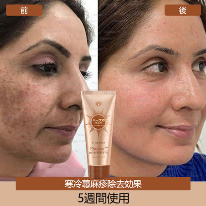 Parowu™シミ・色素沈着除去＆美白マスク(✨天然成分でシミ、色素沈着、日焼けによるシミを長期的にケア)