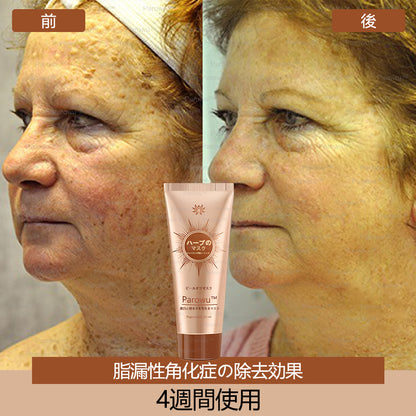 Parowu™シミ・色素沈着除去＆美白マスク(✨天然成分でシミ、色素沈着、日焼けによるシミを長期的にケア)