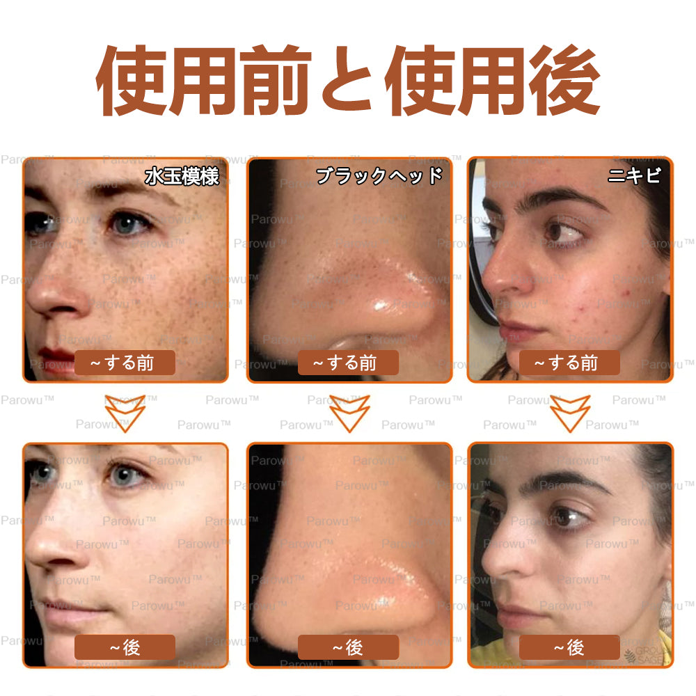 Parowu™シミ・色素沈着除去＆美白マスク(✨天然成分でシミ、色素沈着、日焼けによるシミを長期的にケア)