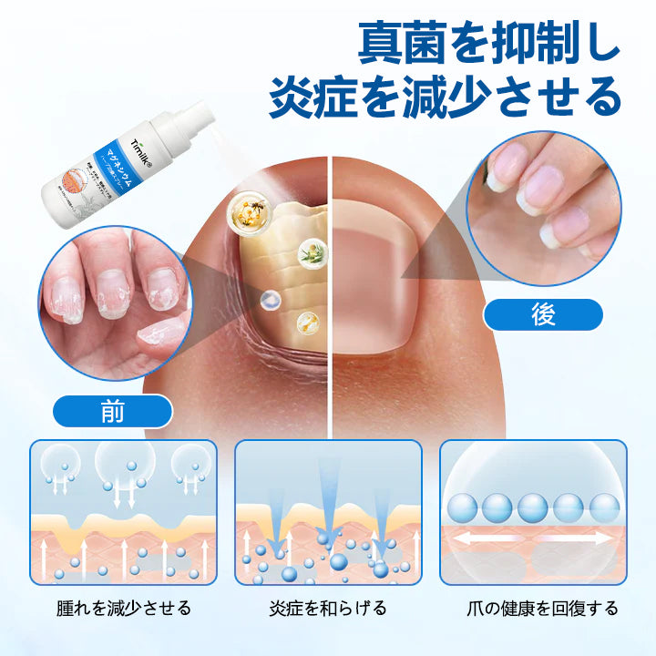 Timilk® マグネシウム ハーバル トリートメントスプレー