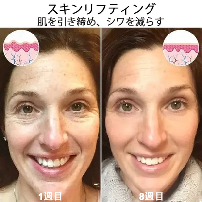 🔥 本日限定の特別セール！今なら80％OFF＆代引き対応可✨ Fubsta™ リフトアップ若返り美容セラム – 今すぐお試しを！