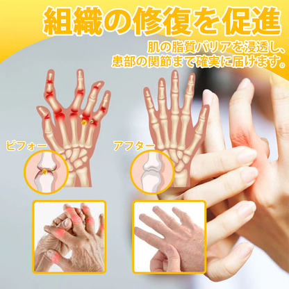 WarmFamily® ボツリヌストキシン＆蜂毒配合 骨治癒促進鎮痛クリーム🐝