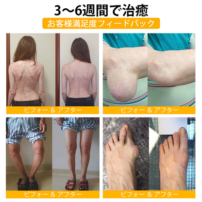 WarmFamily® ボツリヌストキシン＆蜂毒配合 骨治癒促進鎮痛クリーム🐝