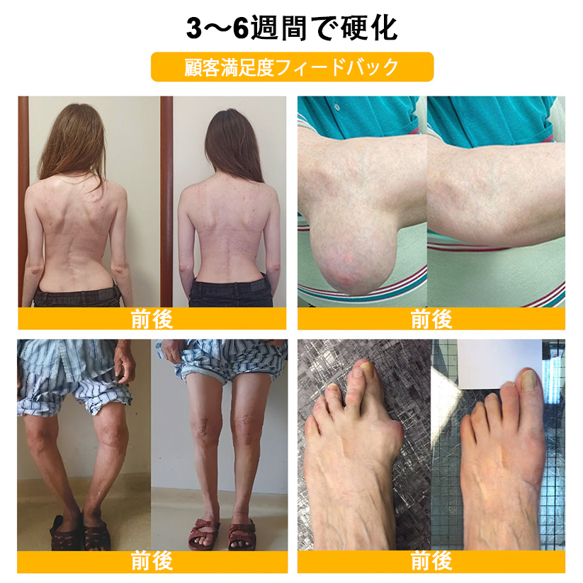 アメリカ製✅🇺🇸TLOPA® ボツリヌストキシン＆蜂毒 骨・関節サポートクリーム （👴高齢の方におすすめ！整形外科医も推奨🐝）