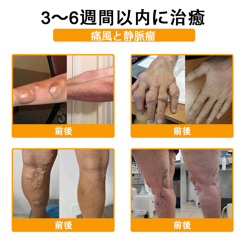 アメリカ製✅🇺🇸TLOPA® ボツリヌストキシン＆蜂毒 骨・関節サポートクリーム （👴高齢の方におすすめ！整形外科医も推奨🐝）