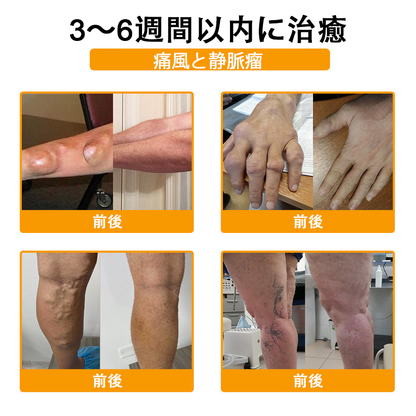 アメリカ製✅🇺🇸TLOPA® ボツリヌストキシン＆蜂毒 骨・関節サポートクリーム （👴高齢の方におすすめ！整形外科医も推奨🐝）