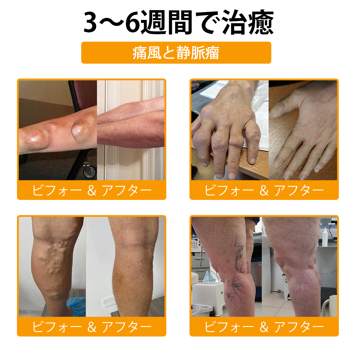 WarmFamily® ボツリヌストキシン＆蜂毒配合 骨治癒促進鎮痛クリーム🐝