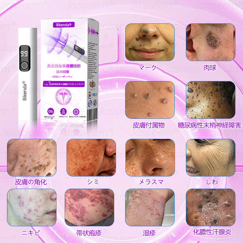 Bikenda® 高性能CO₂レーザーペン 🛫（痛みなし・面倒なしで、イボ・ほくろ・シミ・小さな肌のふくらみをやさしく除去！）お肌のケアにおすすめの非侵襲的アイテムだよ！