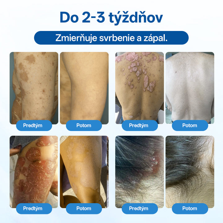 Zyrelvo®✅ Horčíkový bylinný liečebný sprej