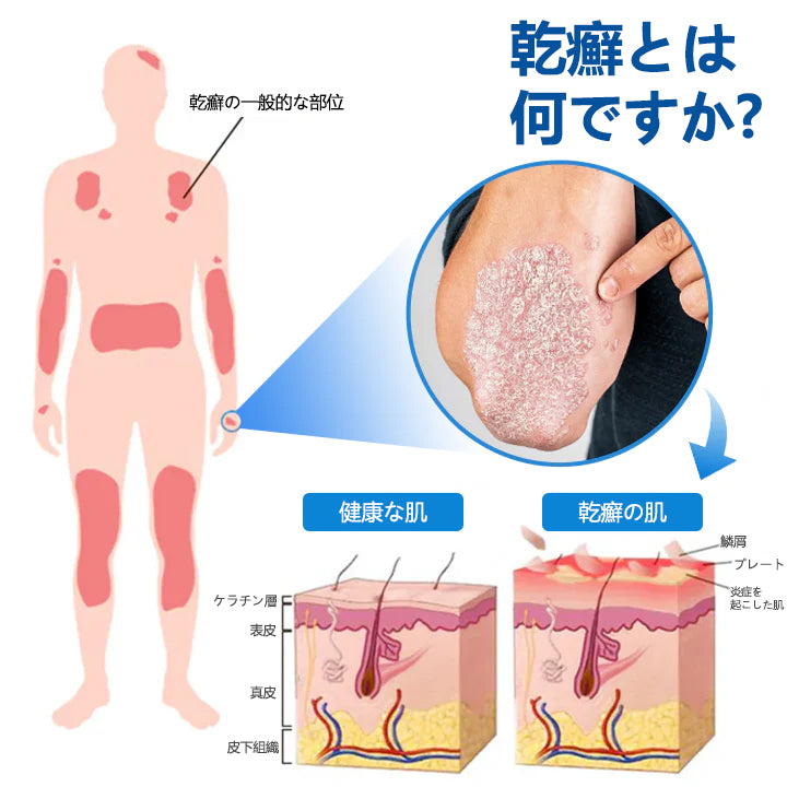 Timilk® マグネシウム ハーバル トリートメントスプレー