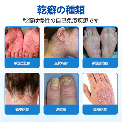 Timilk® マグネシウム ハーバル トリートメントスプレー