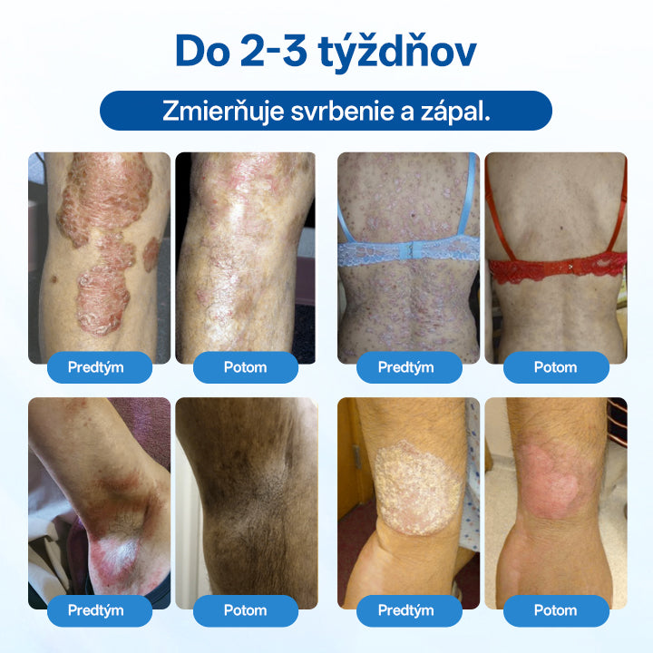 Zyrelvo®✅ Horčíkový bylinný liečebný sprej