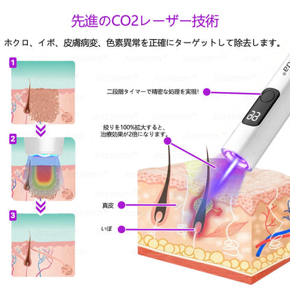 Bikenda® 高性能CO₂レーザーペン 🛫（痛みなし・面倒なしで、イボ・ほくろ・シミ・小さな肌のふくらみをやさしく除去！）お肌のケアにおすすめの非侵襲的アイテムだよ！