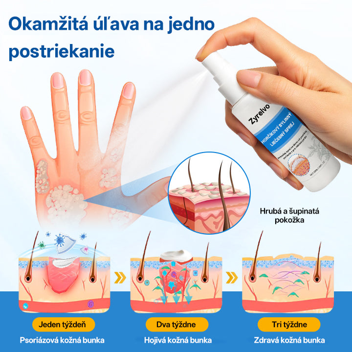 Zyrelvo®✅ Horčíkový bylinný liečebný sprej