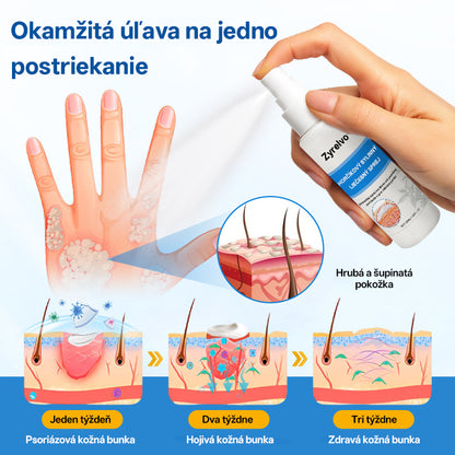 Zyrelvo®✅ Horčíkový bylinný liečebný sprej
