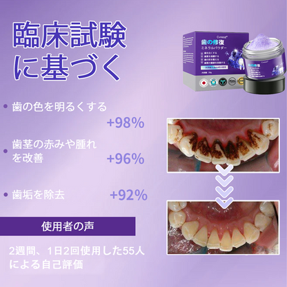 Cvreoz®🎁（ADA推奨）ミネラル歯修復パウダー 🦷 残り30分限定！特別割引実施中 🦷