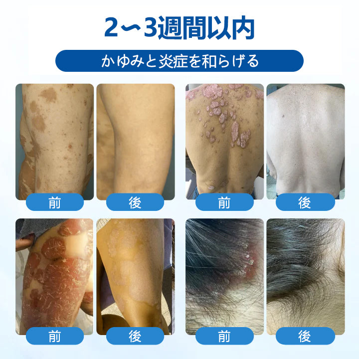 Timilk® マグネシウム ハーバル トリートメントスプレー