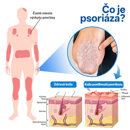 Zyrelvo®✅ Horčíkový bylinný liečebný sprej