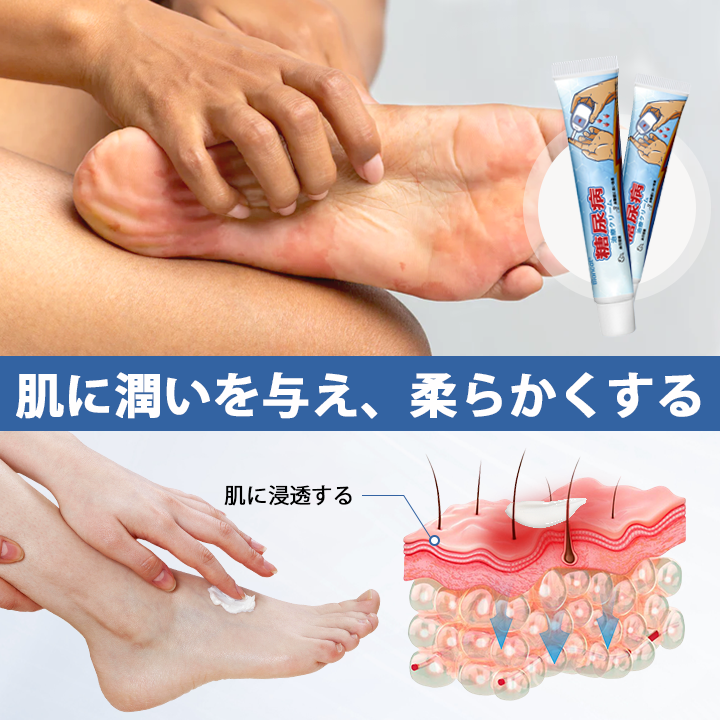 【プロフェッショナルケア】✨糖尿病合併症治療のためのビアンカット™ ビタグルコクリーム