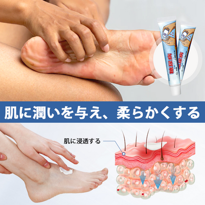 【プロフェッショナルケア】✨糖尿病合併症治療のためのビアンカット™ ビタグルコクリーム