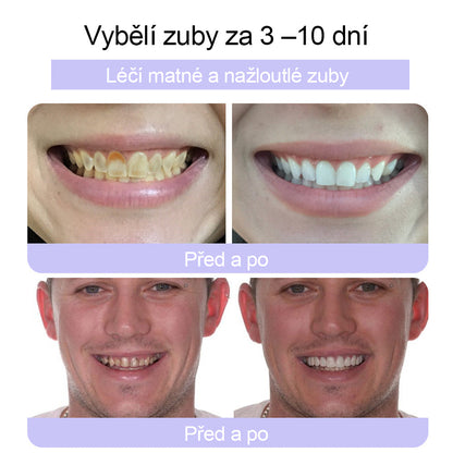 🦷🦷CleraNature® Zubní minerální prášek na obnovu zubů🔮