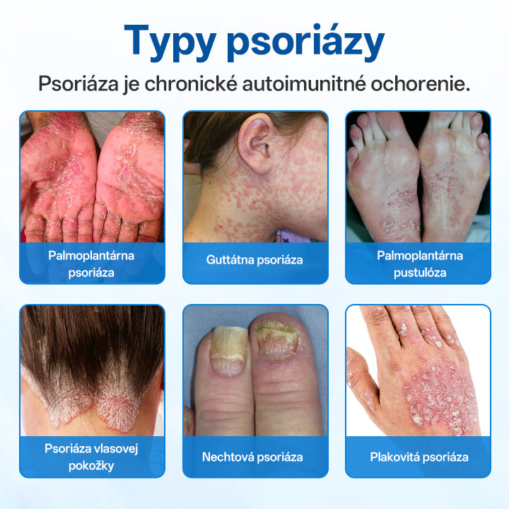 Zyrelvo®✅ Horčíkový bylinný liečebný sprej