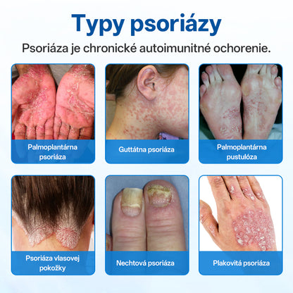 Zyrelvo®✅ Horčíkový bylinný liečebný sprej