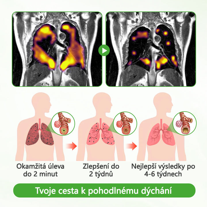 🏅🏅CleraNaure® HerbaAir Mullein Čistič Plic