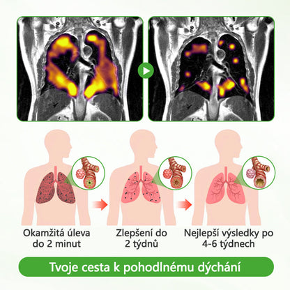 🏅🏅CleraNaure® HerbaAir Mullein Čistič Plic