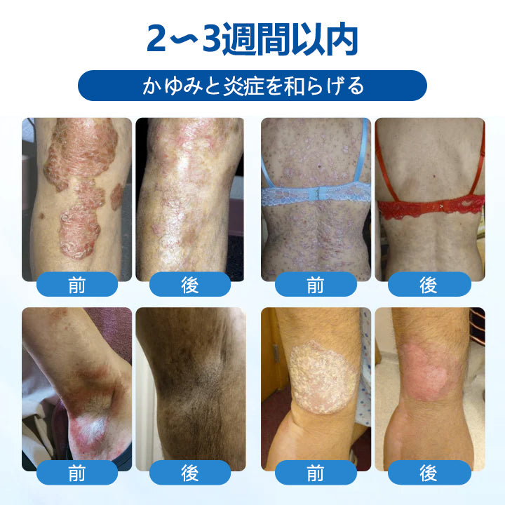 Timilk® マグネシウム ハーバル トリートメントスプレー