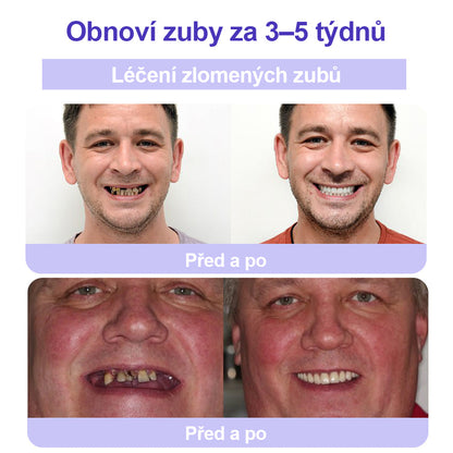🦷🦷CleraNature® Zubní minerální prášek na obnovu zubů🔮