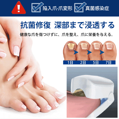 爪真菌対策レーザー治療器