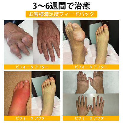 WarmFamily® ボツリヌストキシン＆蜂毒配合 骨治癒促進鎮痛クリーム🐝