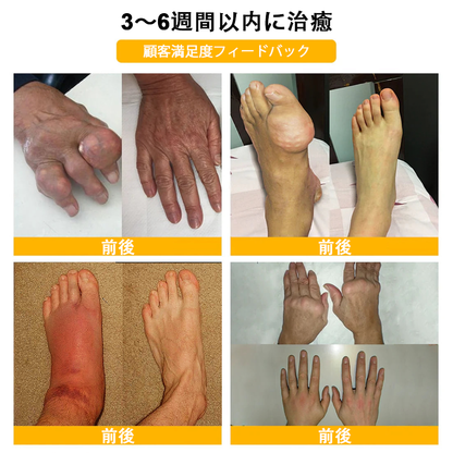 アメリカ製✅🇺🇸TLOPA® ボツリヌストキシン＆蜂毒 骨・関節サポートクリーム （👴高齢の方におすすめ！整形外科医も推奨🐝）