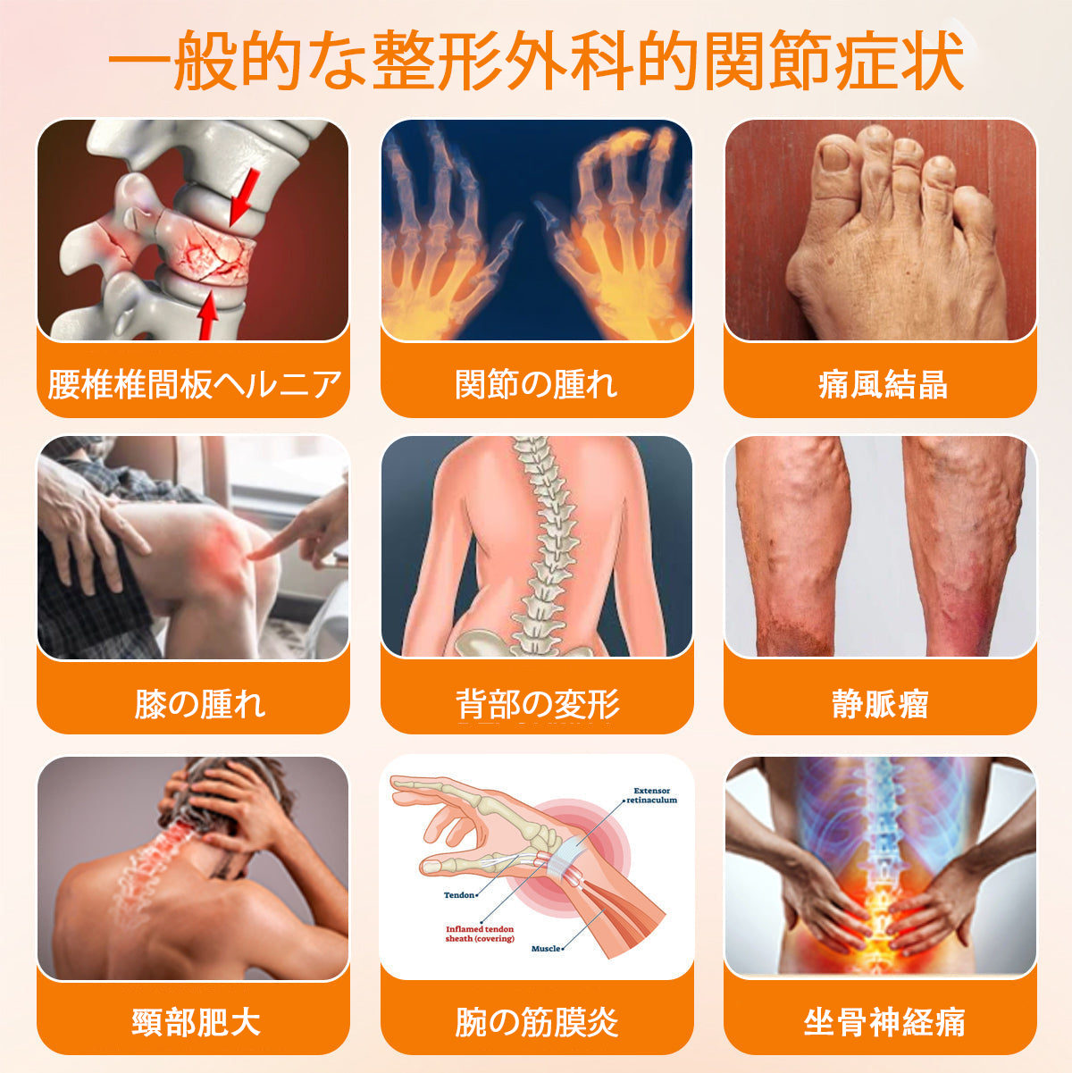 アメリカ製✅🇺🇸TLOPA® ボツリヌストキシン＆蜂毒 骨・関節サポートクリーム （👴高齢の方におすすめ！整形外科医も推奨🐝）