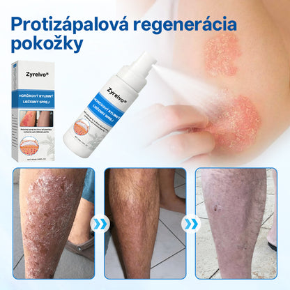 Zyrelvo®✅ Horčíkový bylinný liečebný sprej