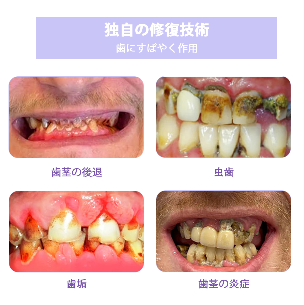 Cvreoz®🎁（ADA推奨）ミネラル歯修復パウダー 🦷 残り30分限定！特別割引実施中 🦷