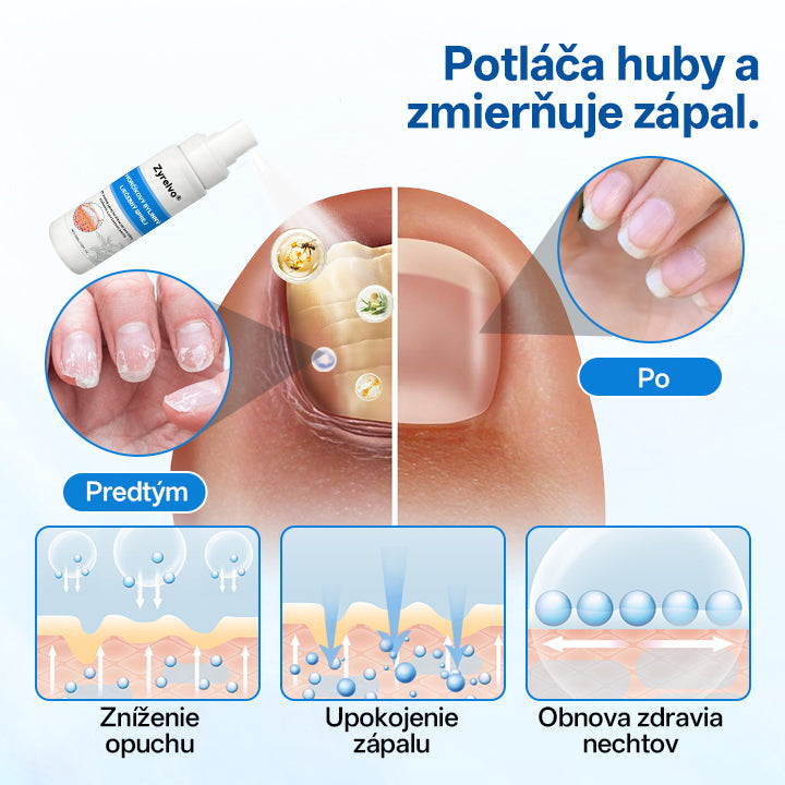 Zyrelvo®✅ Horčíkový bylinný liečebný sprej