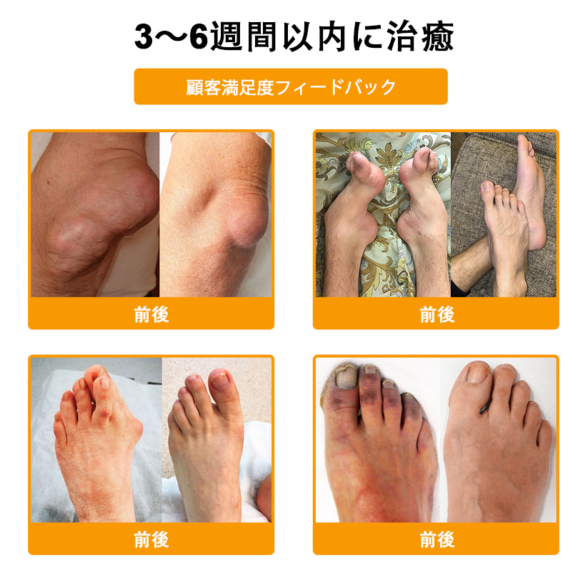 アメリカ製✅🇺🇸TLOPA® ボツリヌストキシン＆蜂毒 骨・関節サポートクリーム （👴高齢の方におすすめ！整形外科医も推奨🐝）