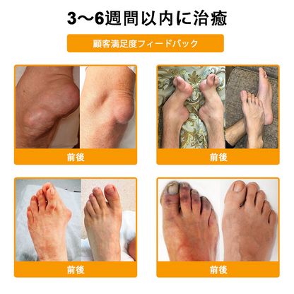 アメリカ製✅🇺🇸TLOPA® ボツリヌストキシン＆蜂毒 骨・関節サポートクリーム （👴高齢の方におすすめ！整形外科医も推奨🐝）